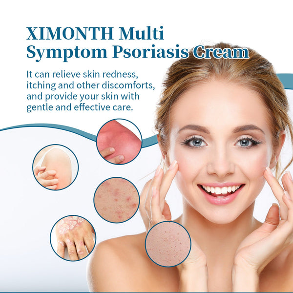 Psoriasis Treatment Cream for Itchy Skin